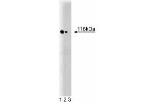 Western blot analysis of TAO1 on a rat cerebrum lysate. (TAO Kinase 2 抗体  (AA 352-550))