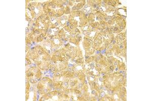 Immunohistochemistry of paraffin-embedded mouse kidney using NDRG1 antibody at dilution of 1:100 (x400 lens). (NDRG1 抗体)