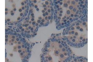 Detection of BPI in Mouse Testis Tissue using Polyclonal Antibody to Bactericidal/Permeability Increasing Protein (BPI)