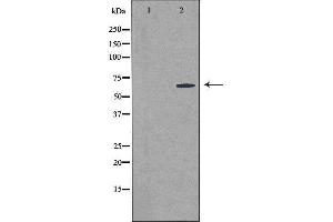 Western blot analysis of extracts from MCF-7 cells using CSTF2T antibody. (CSTF2T 抗体  (N-Term))