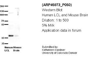 Image no. 2 for anti-Chromosome 21 Open Reading Frame 59 (C21orf59) (N-Term) antibody (ABIN2782393) (C21orf59 抗体  (N-Term))