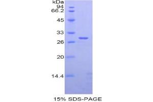 SDS-PAGE analysis of Rat ADAM6 Protein.