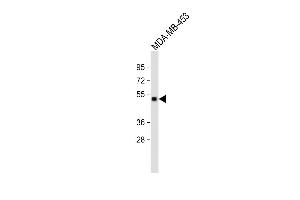 All lanes : Anti-GABRD Antibody (Center) at 1:2000 dilution Lane 1: MDA-MB-453 whole cell lysate Lysates/proteins at 20 μg per lane. (GABRD 抗体  (AA 331-358))