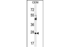 Western blot analysis in CEM cell line lysates (35ug/lane). (TIMP1 抗体  (C-Term))
