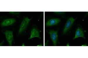 Immunofluorescence (IF) image for anti-Cystathionine-beta-Synthase (CBS) antibody (ABIN2856898)