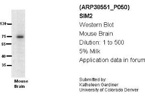 Image no. 1 for anti-Single-Minded Homolog 2 (SIM2) (N-Term) antibody (ABIN2780639) (SIM2 抗体  (N-Term))
