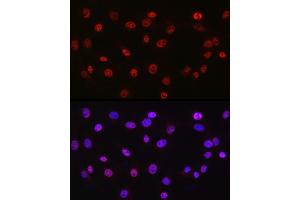 Immunofluorescence analysis of NIH/3T3 cells using DDX39A antibody (ABIN6131590, ABIN6139489, ABIN6139491 and ABIN6223963) at dilution of 1:50. (DDX39 抗体  (AA 178-427))