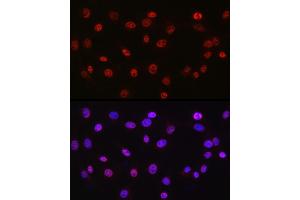 Immunofluorescence analysis of NIH/3T3 cells using DDX39A antibody (ABIN6131590, ABIN6139489, ABIN6139491 and ABIN6223963) at dilution of 1:50. (DDX39 抗体  (AA 178-427))
