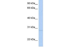 WB Suggested Anti-RNF41 Antibody Titration:  0. (RNF41 抗体  (Middle Region))