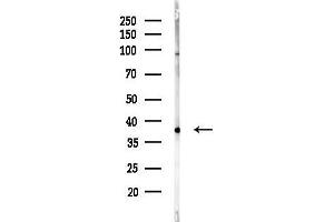 anti-Proline Rich Transmembrane Protein 1 (PRRT1) (N-Term) antibody