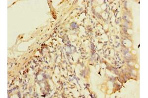 Immunohistochemistry of paraffin-embedded human small intestine tissue using ABIN7163662 at dilution of 1:100 (C10orf81 抗体  (AA 181-462))