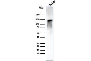 Western Blot Analysis of human ovary tissue lysate using Caldesmon Rabbit Recombinant Monoclonal Antibody (CALD1/1424R). (Recombinant Caldesmon 抗体)