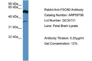 WB Suggested Anti-FSCN2  Antibody Titration: 0. (Fascin 2 抗体  (Middle Region))