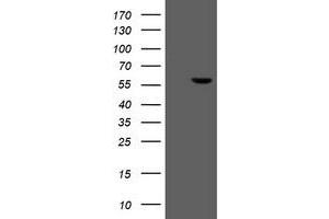 Western Blotting (WB) image for anti-Formiminotransferase Cyclodeaminase (FTCD) antibody (ABIN1496377) (FTCD 抗体)