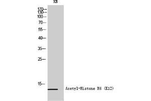 Western Blot analysis of KB cells using Acetyl-Histone H4 (K12) Polyclonal Antibody diluted at 1:500. (Histone H4 抗体  (acLys12))