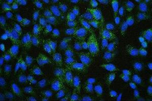 IF analysis of PDCD6IP using anti-PDCD6IP antibody (ABIN7600490). (ALIX 抗体  (AA 2-330))