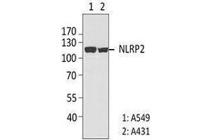 Western Blotting (WB) image for anti-NLR Family, Pyrin Domain Containing 2 (NLRP2) antibody (ABIN2666255) (NLRP2 抗体)