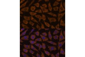 Immunofluorescence analysis of L929 cells using MTMR4 Polyclonal Antibody (ABIN7268764) at dilution of 1:100 (40x lens). (MTMR4 抗体  (AA 920-1195))