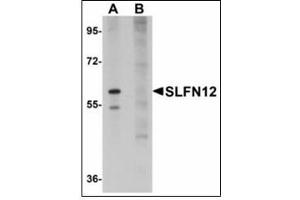 Western blot analysis of SLFN12 in SK-N-SH cell lysate with SLFN12 antibody at 1 µg/ml in (A) the absence and (B) the presence of blocking peptide. (SLFN12 抗体  (C-Term))