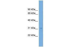 Human COLO205; WB Suggested Anti-NRBF2 Antibody Titration: 0. (NRBF2 抗体  (N-Term))