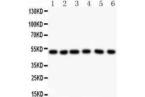 Observed bind size: 49KD (GFAP 抗体  (AA 93-432))