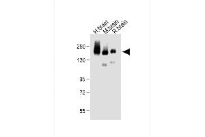 All lanes : Anti-NC Antibody (C-term) at 1:500 dilution Lane 1: Human brain lysate Lane 2: Mouse brain lysate Lane 3: Rat brain lysate Lysates/proteins at 20 μg per lane. (CD56 抗体  (C-Term))