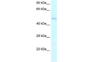 Human Jurkat; WB Suggested Anti-AMBN Antibody. (AMBN 抗体  (C-Term))