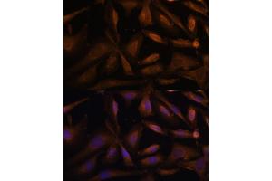 Immunofluorescence analysis of U-2 OS cells using UFC1 Polyclonal Antibody (ABIN6130770, ABIN6149886, ABIN6149887 and ABIN6217098) at dilution of 1:100 (40x lens). (UFC1 抗体  (AA 1-167))
