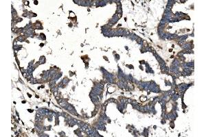 IHC analysis of PICALM using anti-PICALM antibody (ABIN7599516).