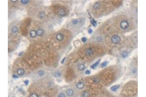 Immunohistochemistry (IHC) image for anti-Keratin 33A (KRT33A) (AA 57-363) antibody (ABIN7441730)