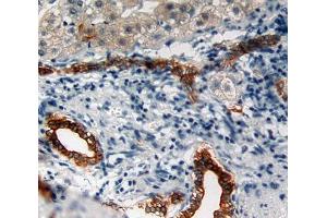 Used in DAB staining on fromalin fixed paraffin- embedded liver tissue (Cytokeratin 5 抗体  (AA 166-474))