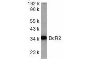 Western Blotting (WB) image for anti-Tumor Necrosis Factor Receptor Superfamily, Member 10d, Decoy with Truncated Death Domain (TNFRSF10D) (AA 249-263) antibody (ABIN2479560) (DcR2 抗体  (AA 249-263))