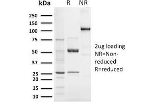 SDS-PAGE Analysis Purified Elastin Recombinant Rabbit Monoclonal Antibody (ELN/3131R). (Recombinant Elastin 抗体)