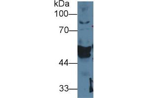 Detection of CK14 in Cavia Salivary gland lysate using Polyclonal Antibody to Cytokeratin 14 (CK14) (KRT14 抗体  (AA 1-484))