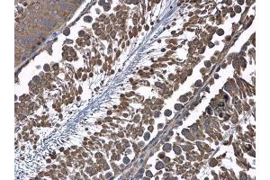 Immunohistochemistry (IHC) image for anti-Hydroxysteroid (17-Beta) Dehydrogenase 4 (HSD17B4) antibody (ABIN2855717)