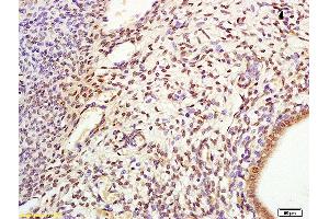Formalin-fixed and paraffin embedded rat uterus labeled with Anti-CDC6 Polyclonal Antibody, Unconjugated (ABIN685852) at 1:200 followed by conjugation to the secondary antibody and DAB staining. (CDC6 抗体)