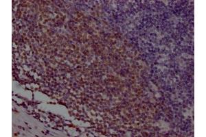 IHC image of ABIN7127370 diluted at 1:100 and staining in paraffin-embedded human appendix tissue performed on a Leica BondTM system. (Recombinant POU2AF1 抗体)