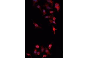 ABIN6269217 staining MCF-7 cells by IF/ICC. (AKT1 抗体)