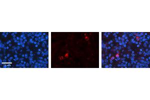 Rabbit Anti-KEAP1 Antibody   Formalin Fixed Paraffin Embedded Tissue: Human Lymph Node Tissue Observed Staining: Cytoplasm, Nucleus Primary Antibody Concentration: 1:100 Other Working Concentrations: N/A Secondary Antibody: Donkey anti-Rabbit-Cy3 Secondary Antibody Concentration: 1:200 Magnification: 20X Exposure Time: 0. (KEAP1 抗体  (N-Term))