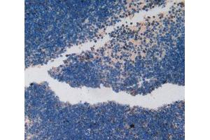 Used in DAB staining on fromalin fixed paraffin- embedded spleen tissue (Ki-67 抗体  (AA 2386-2674))