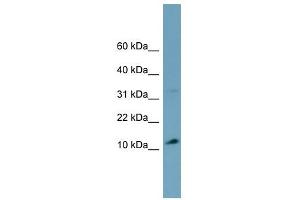 TRIM36 antibody used at 1 ug/ml to detect target protein. (TRIM36 抗体  (Middle Region))
