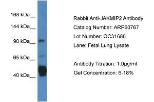 Western Blotting (WB) image for anti-Janus Kinase and Microtubule Interacting Protein 2 (JAKMIP2) (C-Term) antibody (ABIN2788569) (JAKMIP2 抗体  (C-Term))