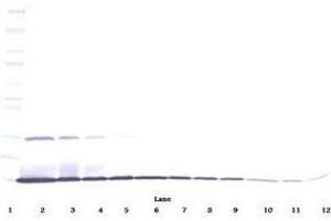 Image no. 1 for anti-Interleukin 22 (IL22) antibody (ABIN465488) (IL-22 抗体)