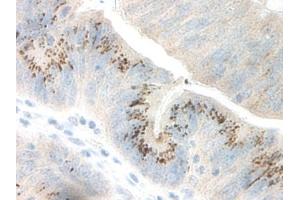 Image no. 2 for anti-Growth Regulated Oncogene gamma (GRO gamma) antibody (ABIN465908) (GRO gamma 抗体)