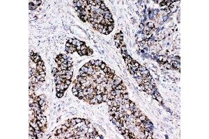 Immunohistochemistry (IHC) image for anti-Peroxiredoxin 3 (PRDX3) (AA 239-256) antibody (ABIN3032188)