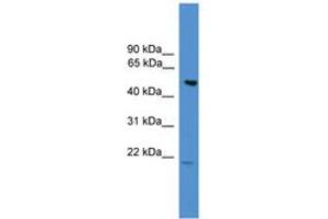 Image no. 1 for anti-Amyotrophic Lateral Sclerosis 2 (Juvenile) Chromosome Region, Candidate 12 (ALS2CR12) (AA 110-159) antibody (ABIN6745420) (ALS2CR12 抗体  (AA 110-159))
