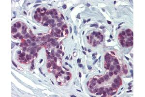 Immunohistochemistry (IHC) image for anti-CREB Binding Protein (CREBBP) (N-Term) antibody (ABIN2781491) (CBP 抗体  (N-Term))
