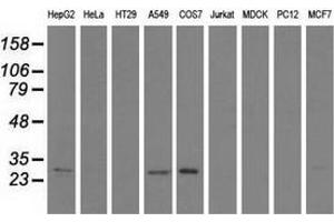 Western blot analysis of extracts (35 µg) from 9 different cell lines by using anti-SPR monoclonal antibody. (SPR 抗体)