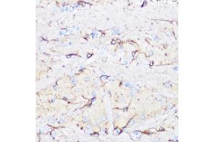 Immunohistochemistry (IHC) image for anti-Glial Fibrillary Acidic Protein (GFAP) (C-Term) antibody (ABIN3020751)