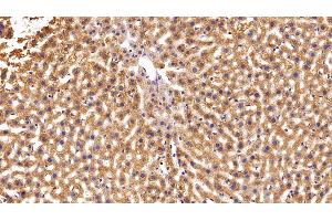 Immunohistochemistry (IHC) image for anti-Nucleoside diphosphate kinase B (NME2) (AA 8-149) antibody (ABIN7439627)